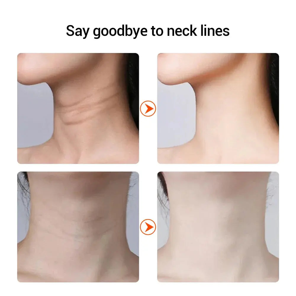 EMS Neck Lifting & Firming Device with LED – view 2