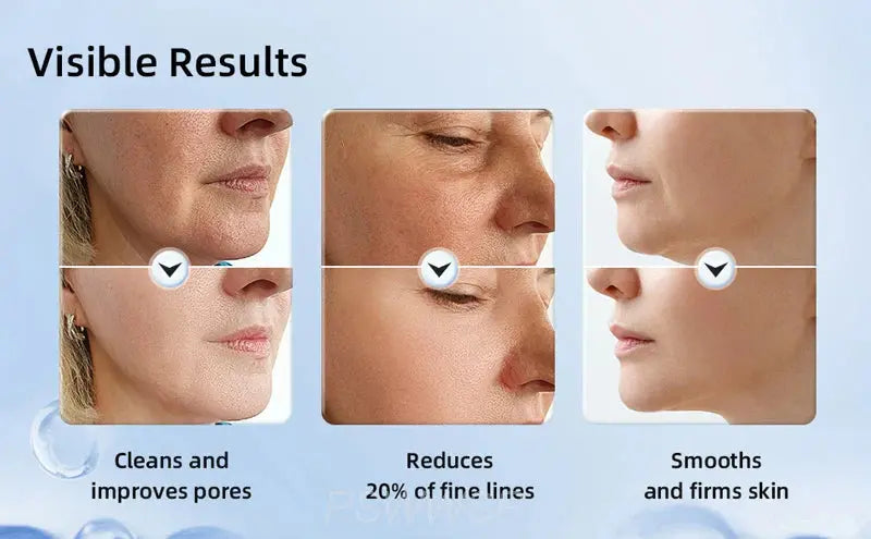 Facial & Neck Massager with LED & EMS – view 3