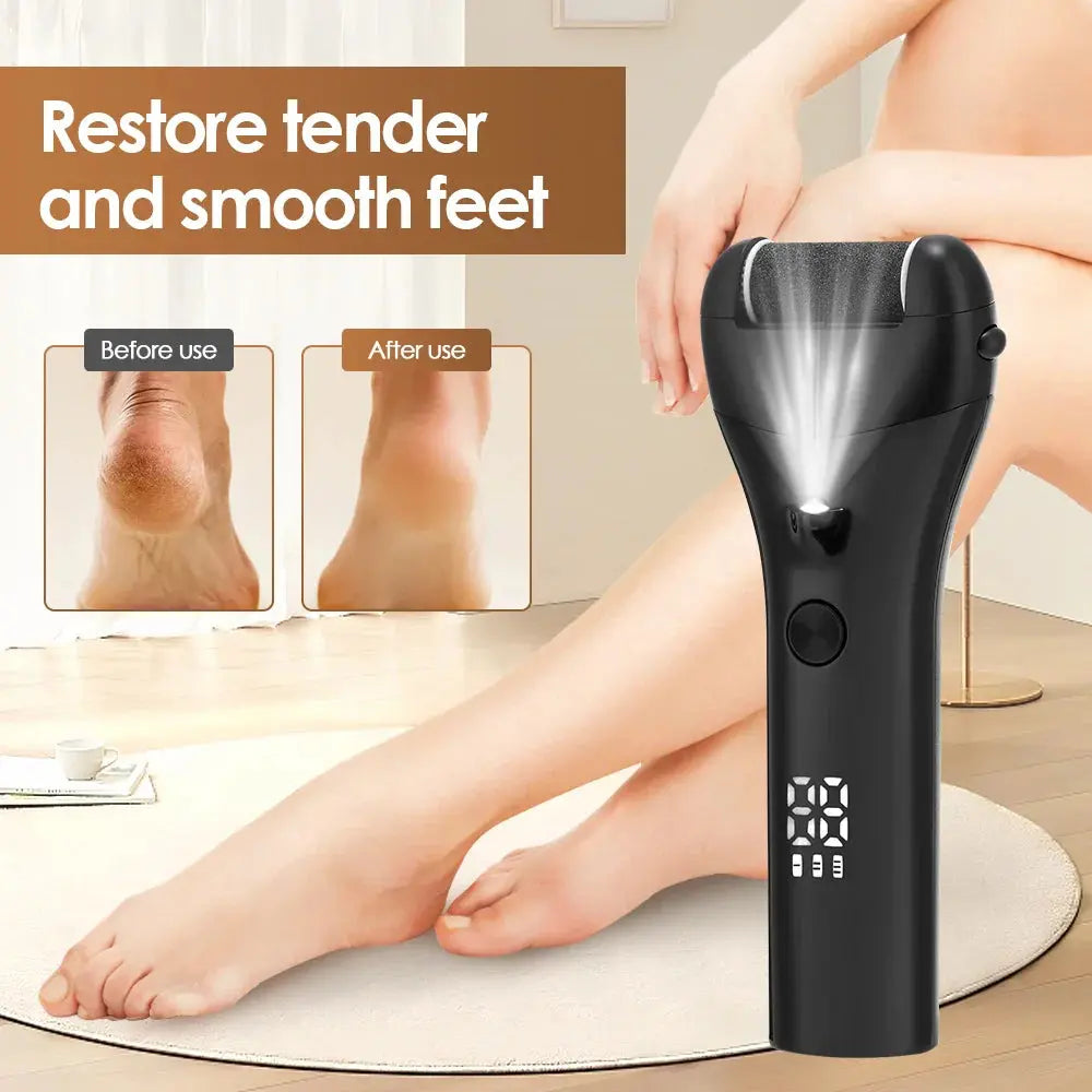 Electric Foot Callus Remover – Cordless – view 3